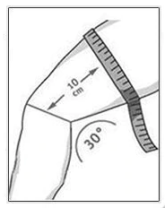 knee brace measurement - teutaivas.fi